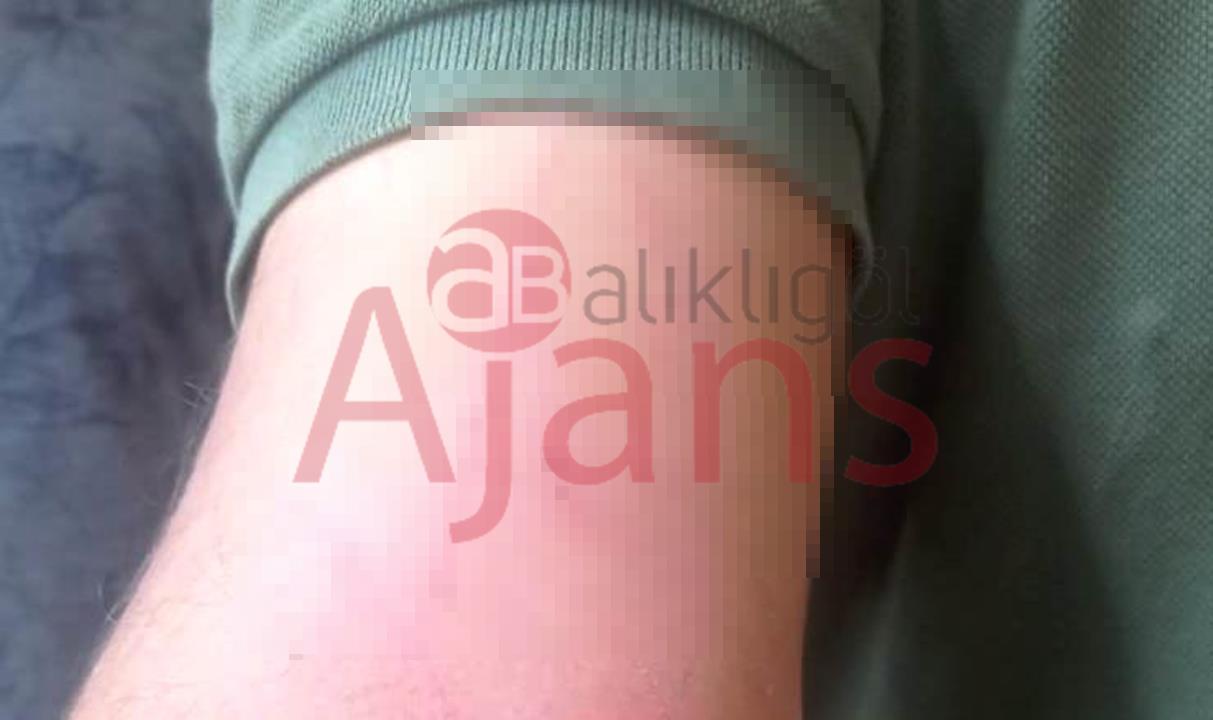 Şanlıurfa'da köpeğin saldırdığı 1 kişi kolundan 1 kişi ise bacağından yaralandı.