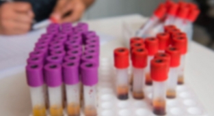 Sağlık Bakanlığı açıkladı: Ücretsiz olacak