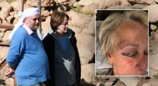 Klaus Schmidt'in eşi Şanlıurfa'da saldırıya uğradı