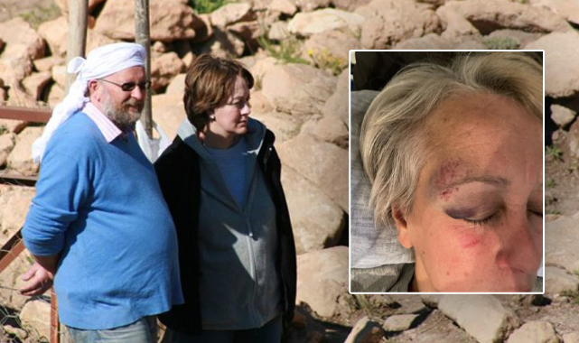 Klaus Schmidt'in eşi Şanlıurfa'da saldırıya uğradı