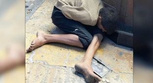 Madde bağımlısı genç yürekleri dağladı