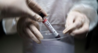 Son 24 saatte vaka ve ölüm sayıları arttı