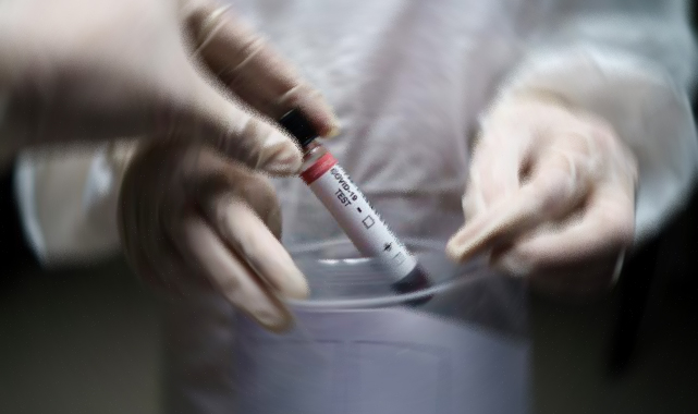 Son 24 saatte vaka ve ölüm sayıları arttı