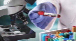 Koronavirüs 187 can daha aldı