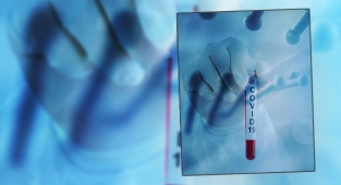 Koronavirüs nedeniyle 24 saatte 191 kişi öldü