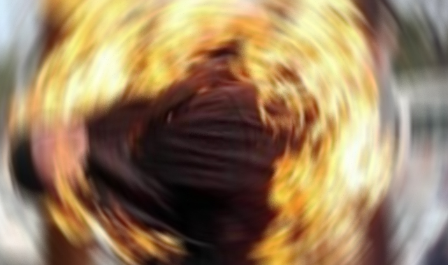 Şanlıurfa’da bir kadın üzerine benzin dökerek kendini ateşe verdi