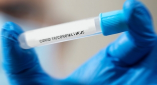 Günlük vaka sayısı 78 bine dayandı: O halde güç bizde!