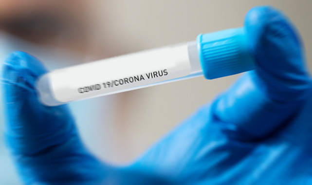 Günlük vaka sayısı 78 bine dayandı: O halde güç bizde!