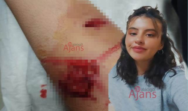 Harran Üniversitesinde köpek saldırısı! Genç kız yaralandı