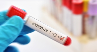 25 Şubat koronavirüs tablosu açıklandı: 266 ölü