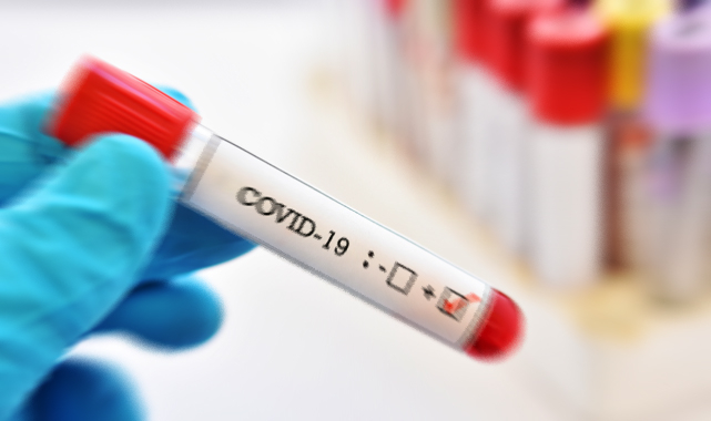 25 Şubat koronavirüs tablosu açıklandı: 266 ölü