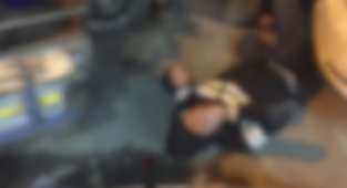 Bozova'da motosikletin çarptığı çocuk yaralandı