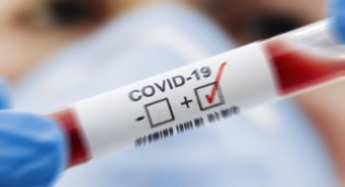 Güncel vaka tablosu açıklandı