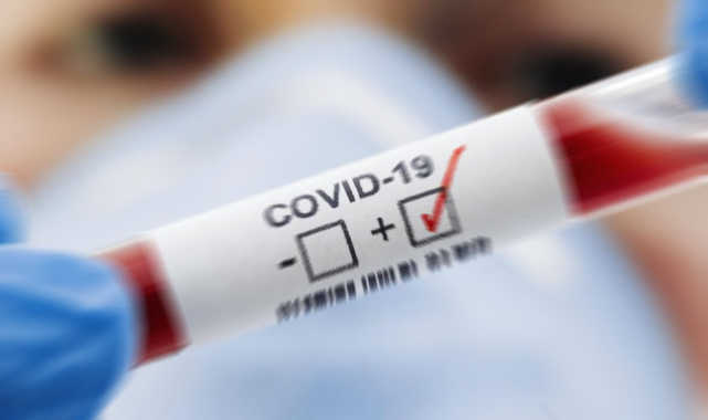 Güncel vaka tablosu açıklandı