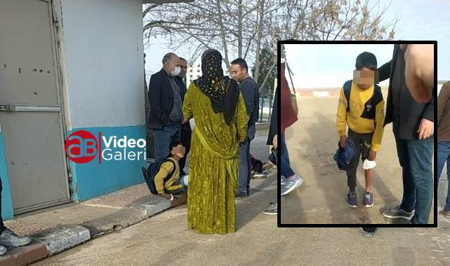 Urfa'da sokak köpekleri 3 çocuğu yaraladı