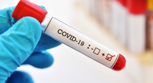 Günlük vaka sayıları 60 binin altına düştü