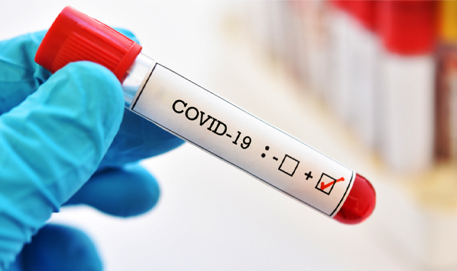 Günlük vaka sayıları 60 binin altına düştü