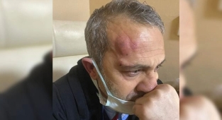 Sağlık çalışanına darp olayında 2 tutuklama