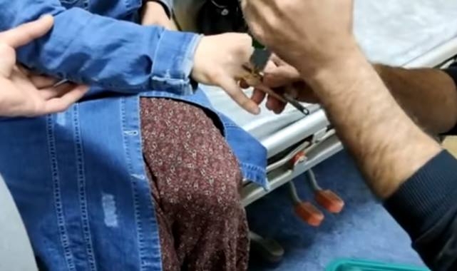 Parmağına yüzük sıkışan kadının imdadına itfaiye yetişti