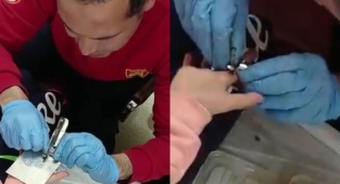 Şanlıurfa İtfaiyesinden parmak operasyonu