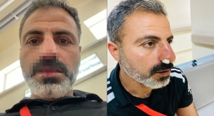 Şanlıurfa takımına çirkin saldırı!