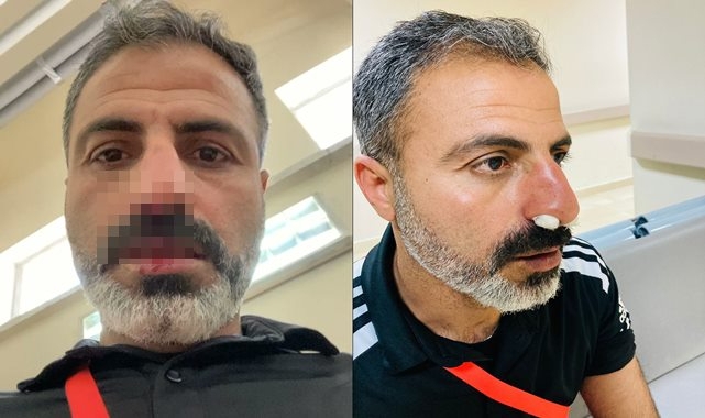 Şanlıurfa takımına çirkin saldırı!