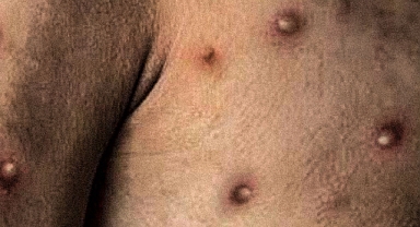 Maymun çiçeğinin görüldüğü il belli oldu 