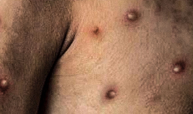 Maymun çiçeğinin görüldüğü il belli oldu