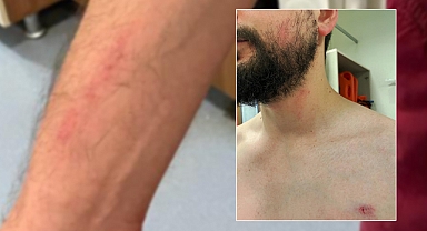 Şanlıurfa'da acil serviste darp