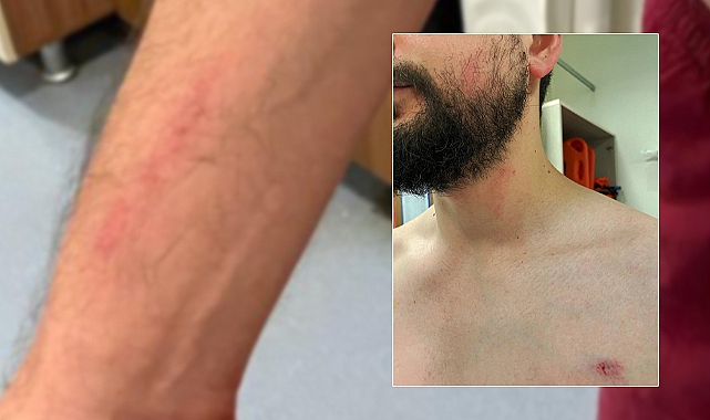 Şanlıurfa'da acil serviste darp