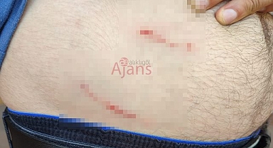 Şanlıurfa'da sokak köpeğinin saldırısına uğrayan vatandaş yaralandı