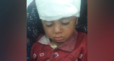 Şanlıurfa'da atın teptiği çocuk yaralandı 