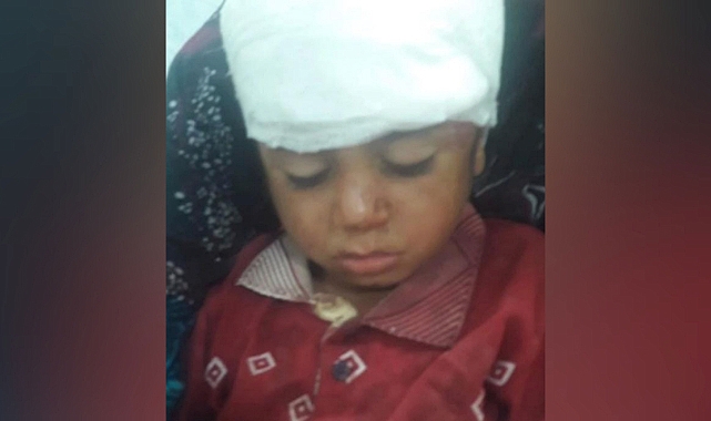 Şanlıurfa'da atın teptiği çocuk yaralandı