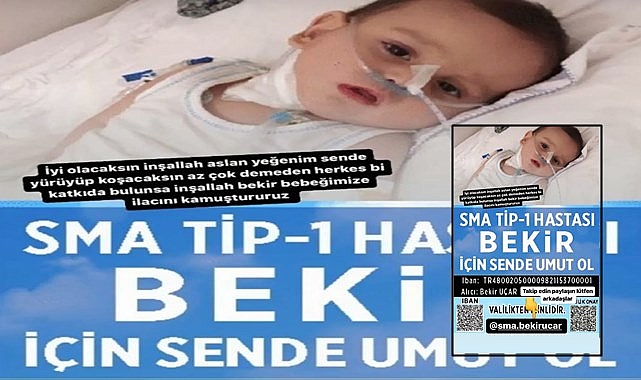 SMA hastası Bekir bebek Şanlıurfa’nın desteğini bekliyor!