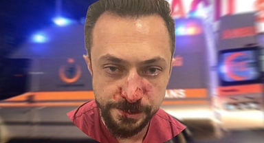 Urfa'da bir doktor darp edildi! Burnu kırıldı