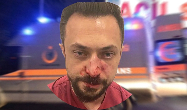 Urfa'da bir doktor darp edildi! Burnu kırıldı