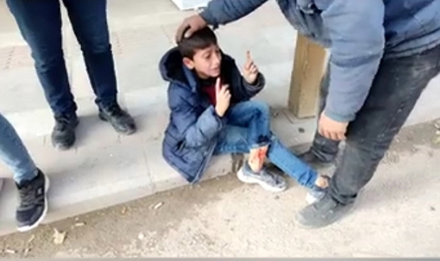 Urfa'nın ilçesinde çocuğa çarpan araç olay yerinden kaçtı