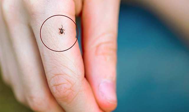 Yeni kenelerle bulaşan hastalık yayılıyor olabilir