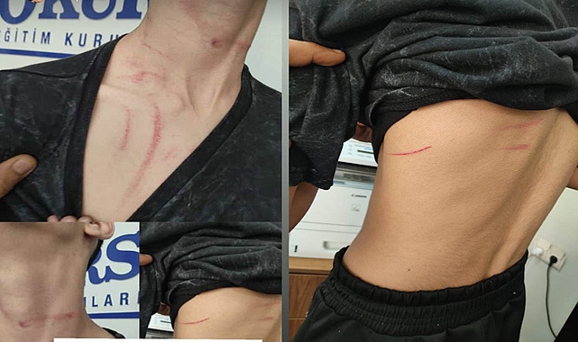 Oruç tutmadığı için darp edildiği iddia edilmişti! Valilik açıklama yaptı