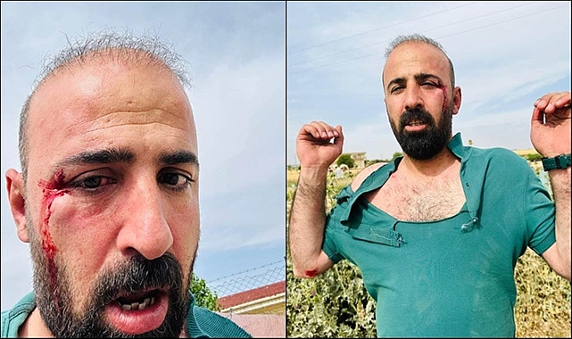 HDP Urfa Eş Başkanı Ahmet Atış saldırıya uğradı