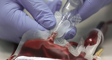 Bryan Johnson'ın Yaşlanma Karşıtı Kan Transfüzyonu: Nasıl çalışır?