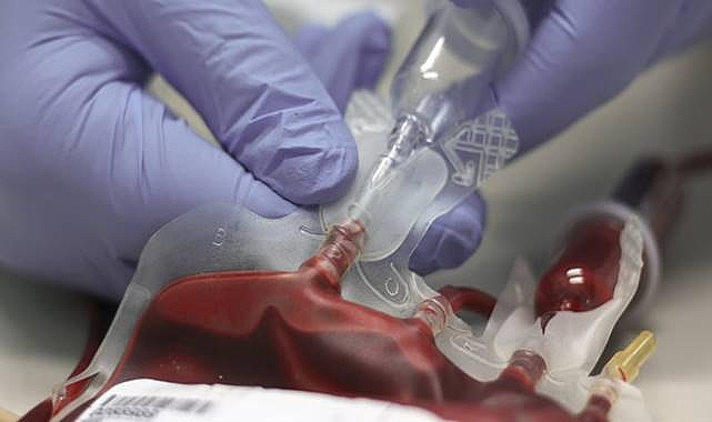 Bryan Johnson'ın Yaşlanma Karşıtı Kan Transfüzyonu: Nasıl çalışır?