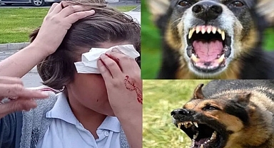 Urfa'da çoban köpeği 3 çocuğa saldırdı