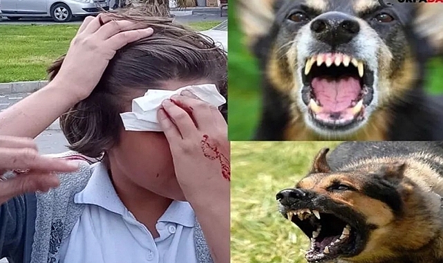 Urfa'da çoban köpeği 3 çocuğa saldırdı
