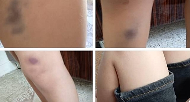 Urfa’da bir okulda skandal olay! 1. Sınıf öğrencisine şiddet iddiası