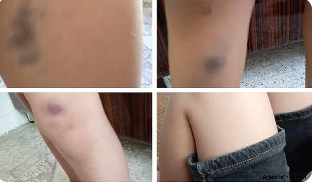 Urfa’da bir okulda skandal olay! 1. Sınıf öğrencisine şiddet iddiası