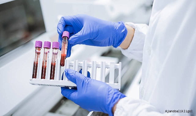 Alzheimer için yeni kan testi taraması ufukta