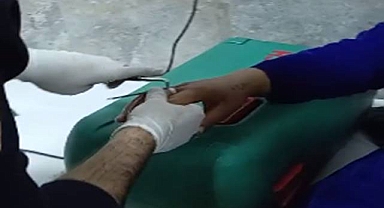 Parmağında sıkışan yüzüğü itfaiye ekipleri çıkardı