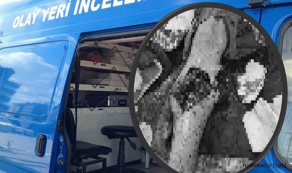 Hilvan'da feci olay! Ayağı parçalandı