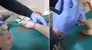 Şanlıurfa itfaiyesinden yüzük operasyonu!